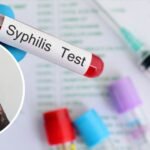 sifilis