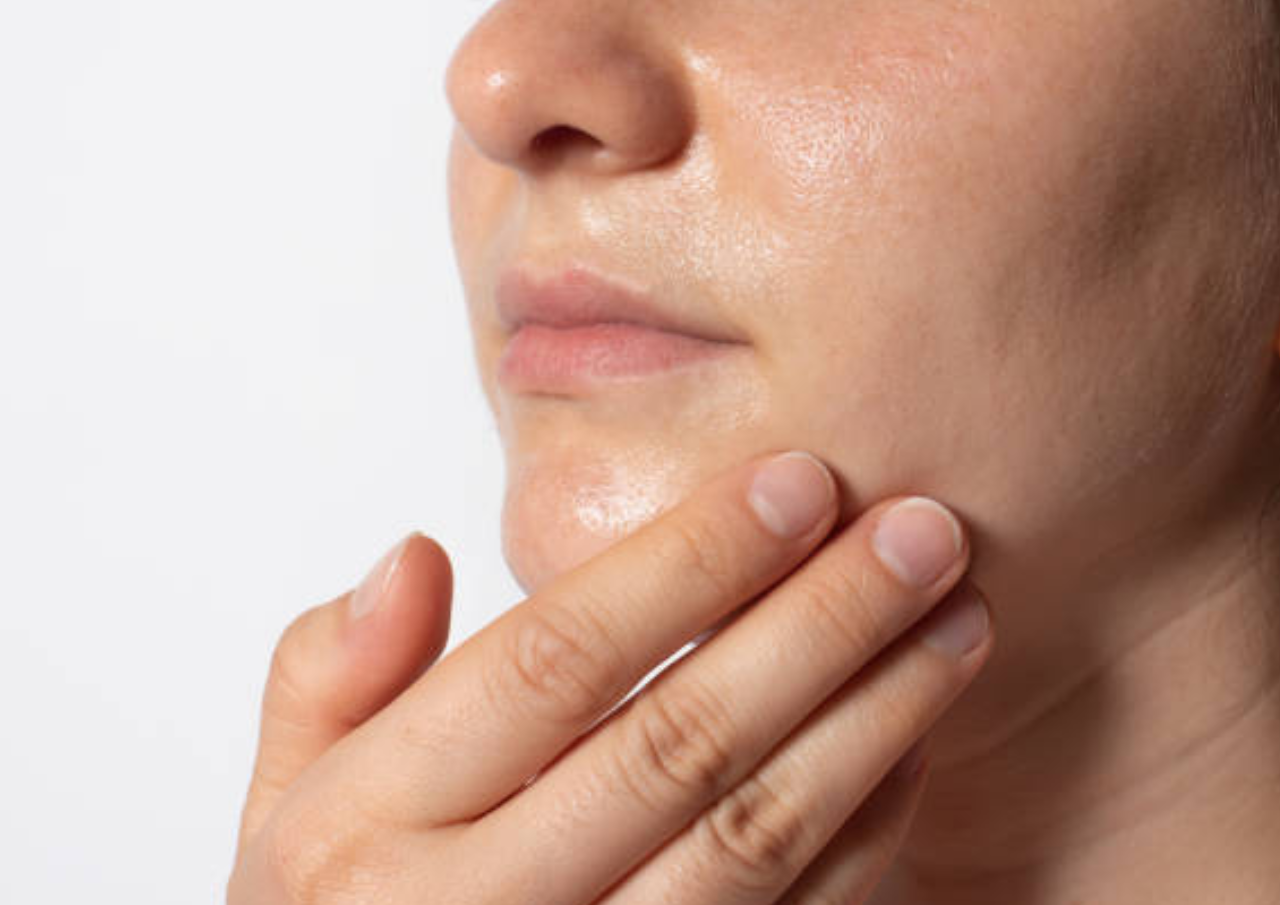 Ingin Wajah Tak BerminyakBerikut Kandungan Bahan yang Harus Dihindari saat Membeli Skincare