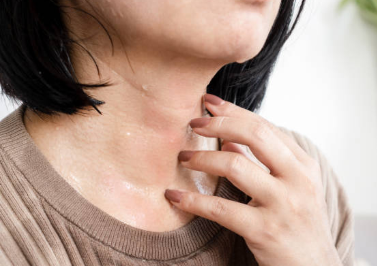 Panas Dalam saat Idul Fitri, Berikut Cara Mengatasinya