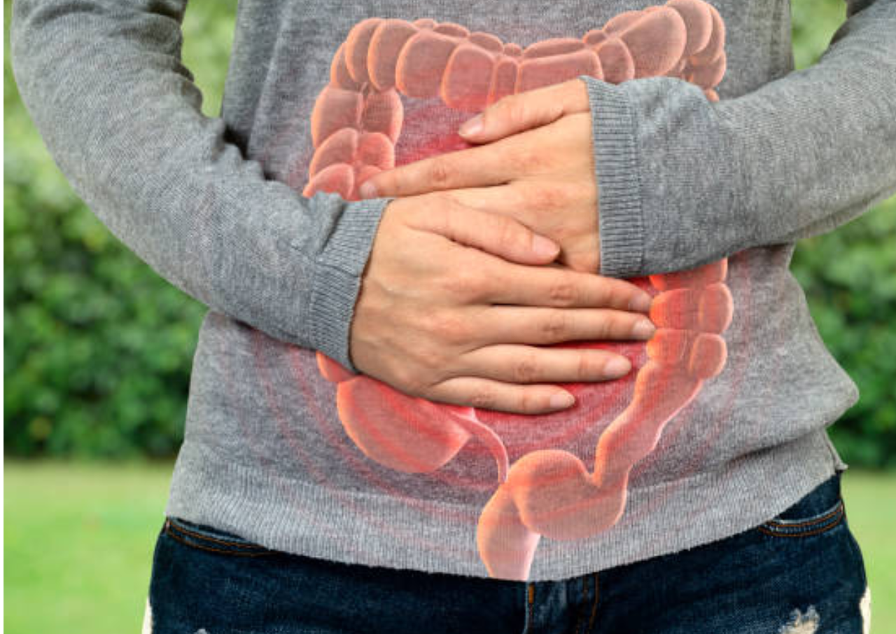 Kenali Gejala hingga Penyebab Radang Usus