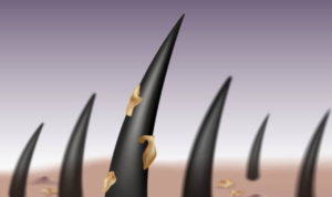 Cara Mengatasi Infeksi Kulit Kepala