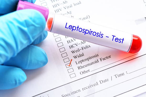 Ilustrasi Leptospirosis /istock Ilustrasi Leptospirosis /istock